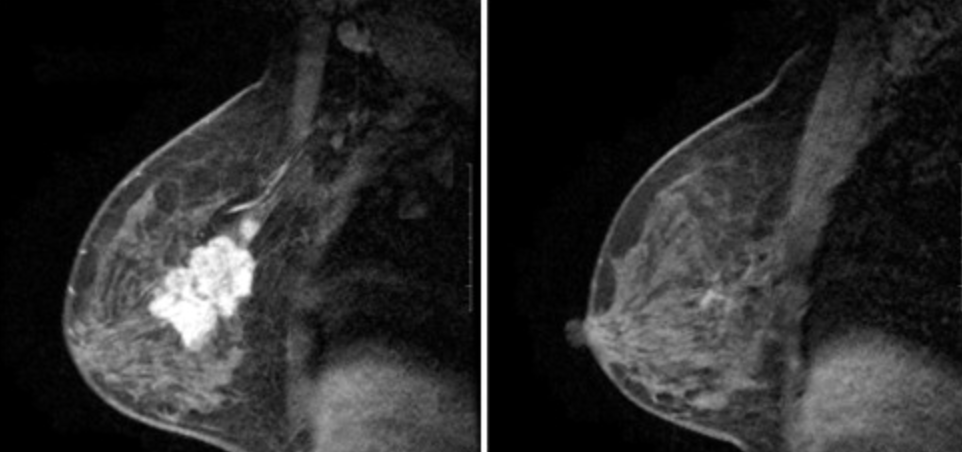 complete mri response